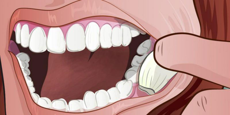 سیر برای دندان درد